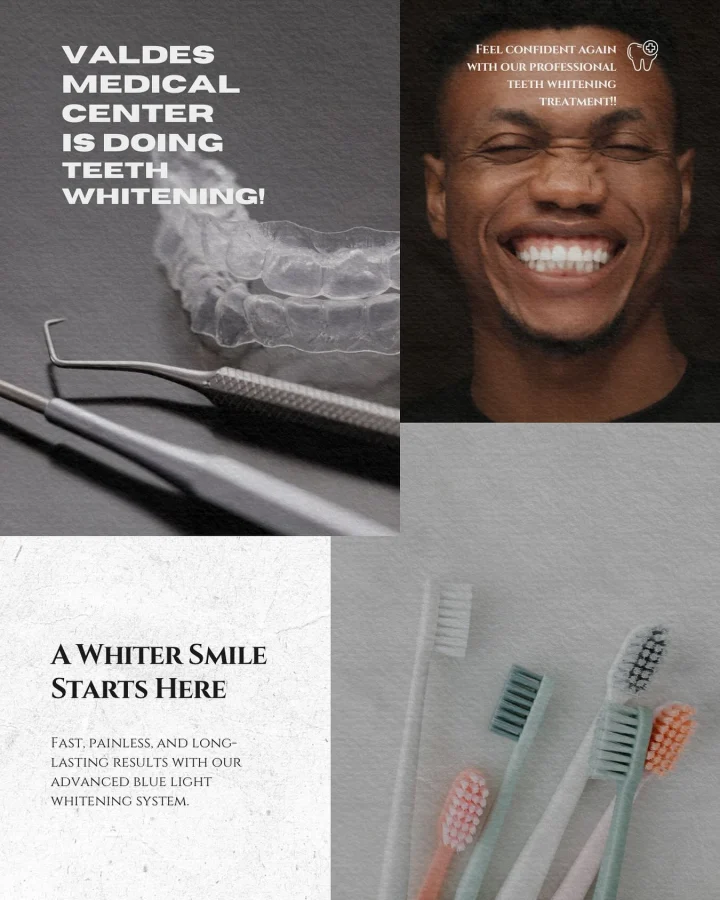Teeth whitening treatment at Valdes Medical Center